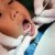 Study finds widespread oral health problems among Navajo